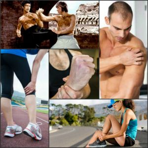 excercise injuries